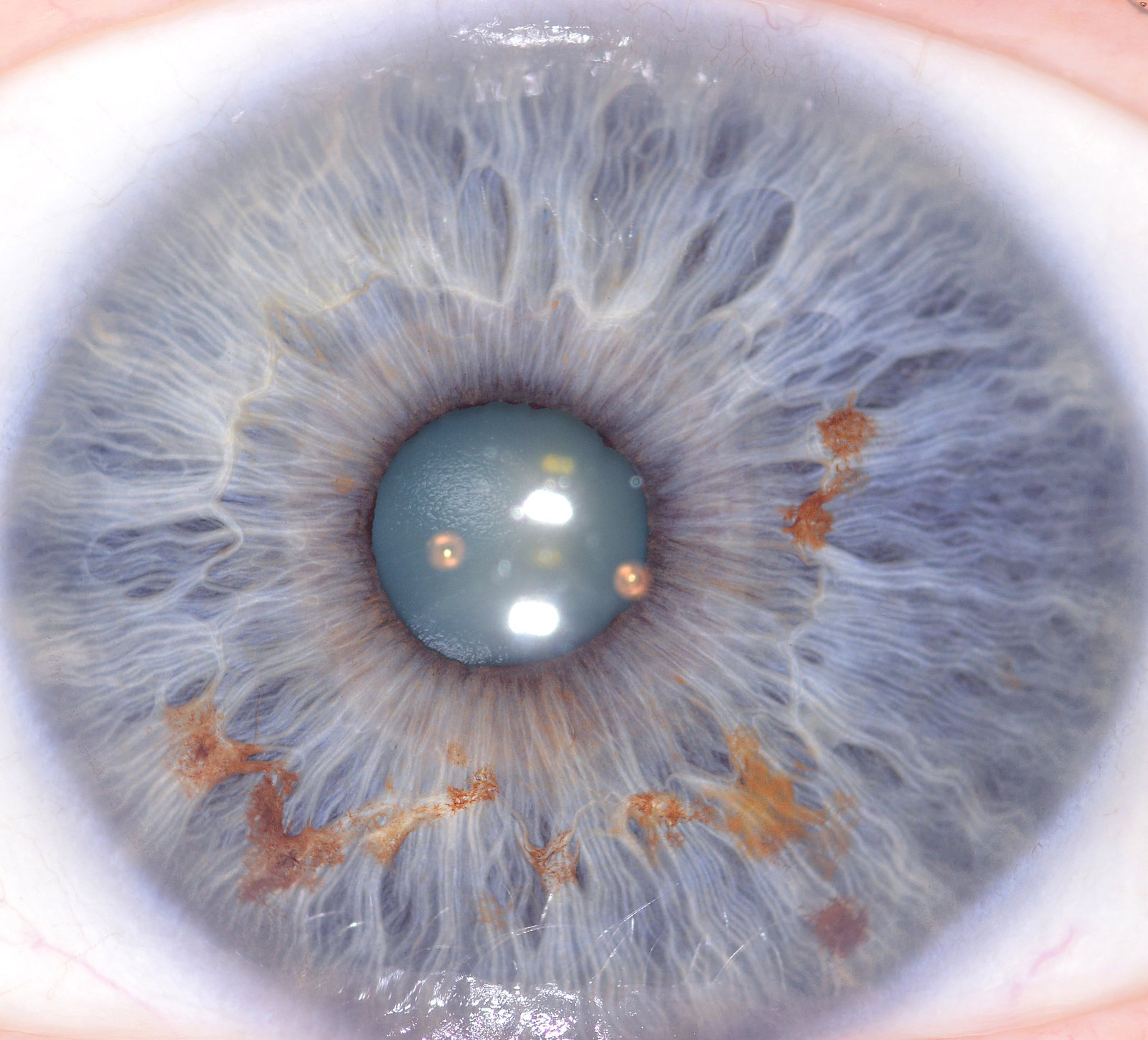 iridologie 6