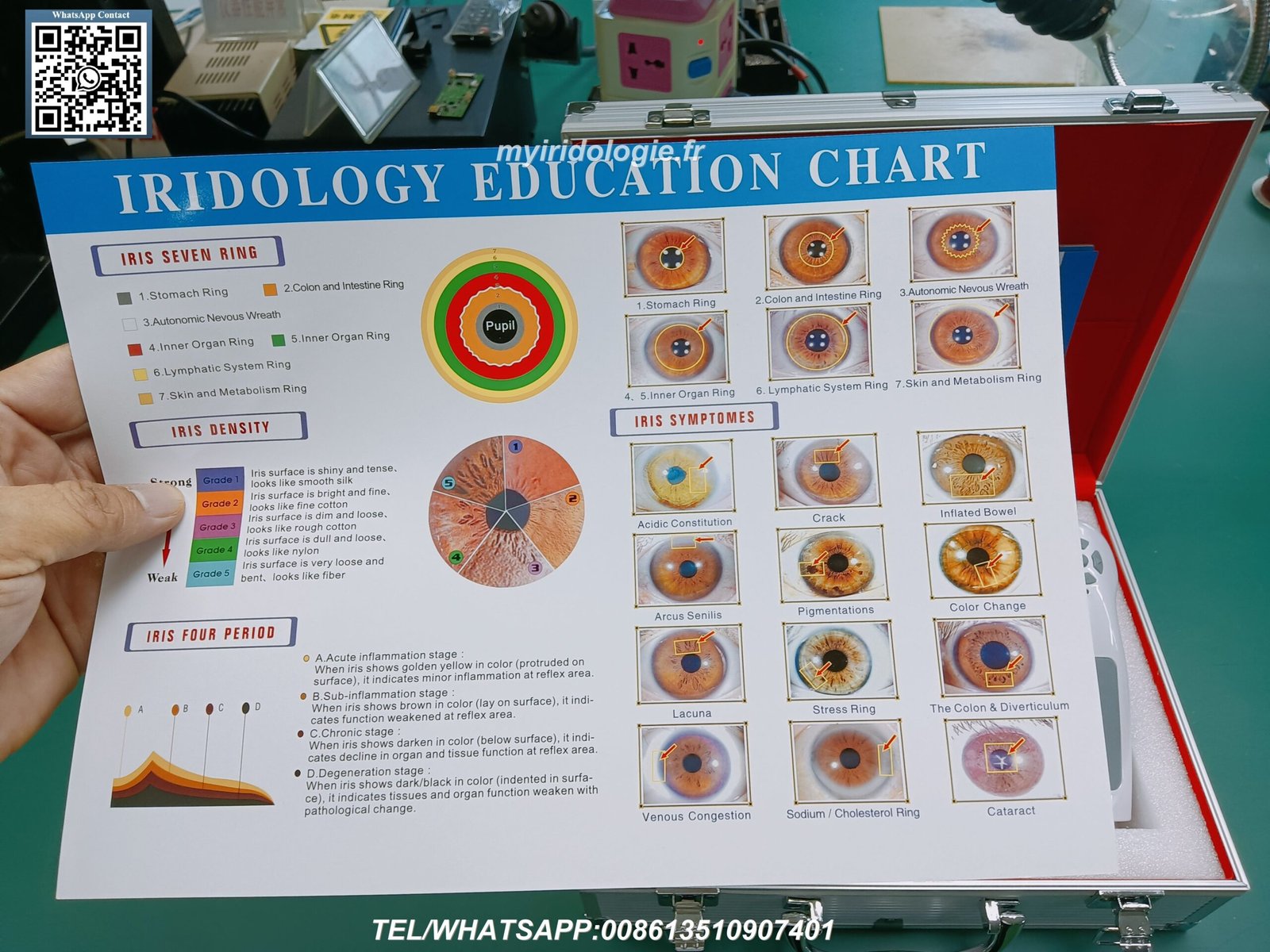 loupe pour iridologieloupe pour iridologie