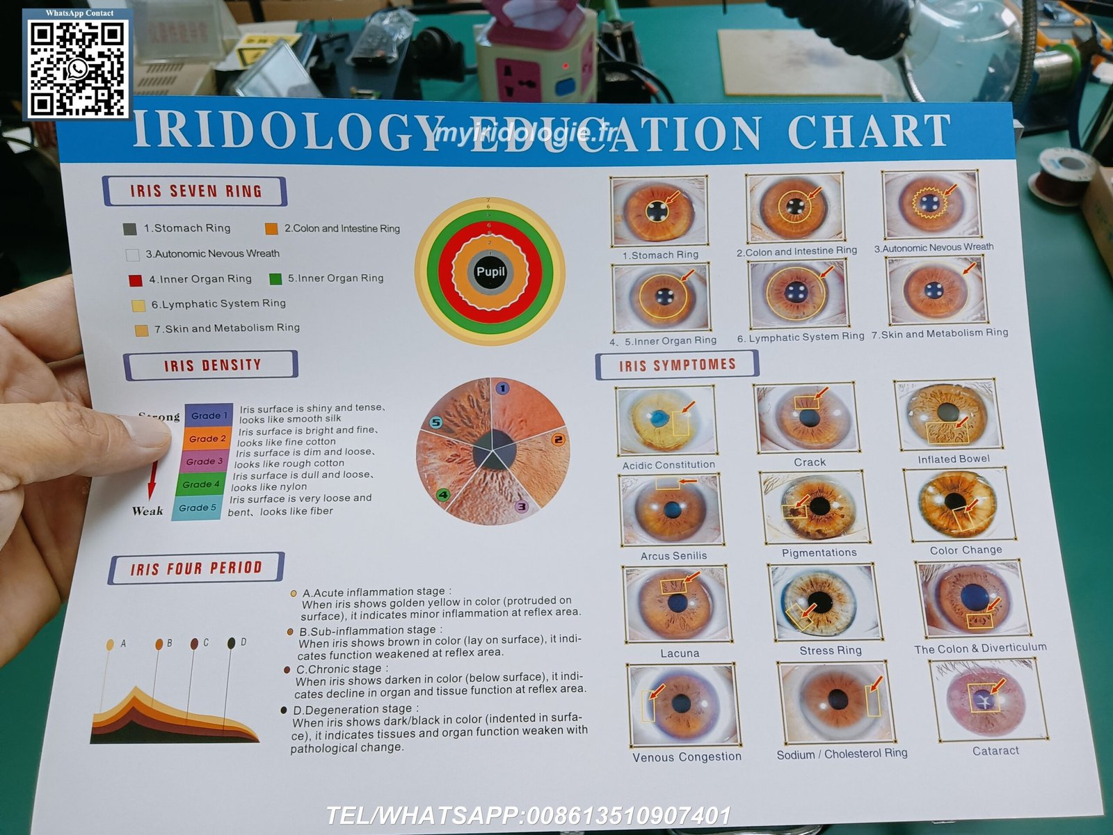 MAIKONG IRIDOLOGY camera factory