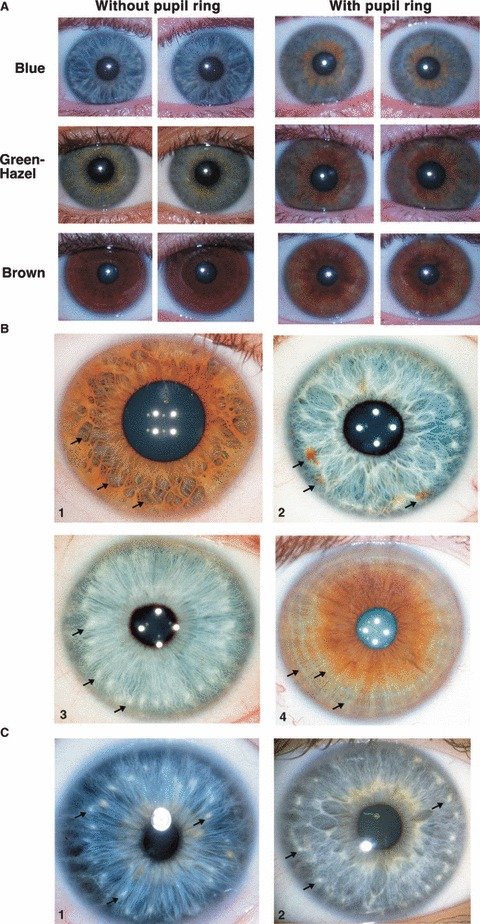 Comparaison de différents types d'iris montrant les variations de couleur et de structure