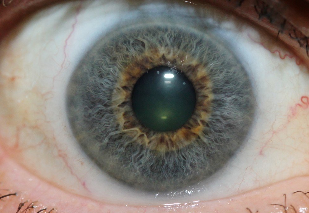 IRIDOLOGY 