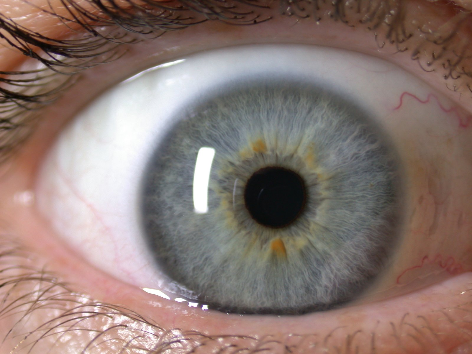 Fonction d'analyse d'iris du logiciel MAIKONG iridologie