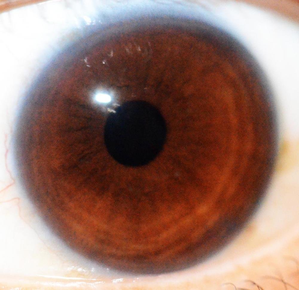 MAIKONG IRIDOLOGY CAMERA (1585)