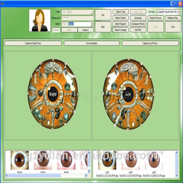 MAIKONG Iridologie software