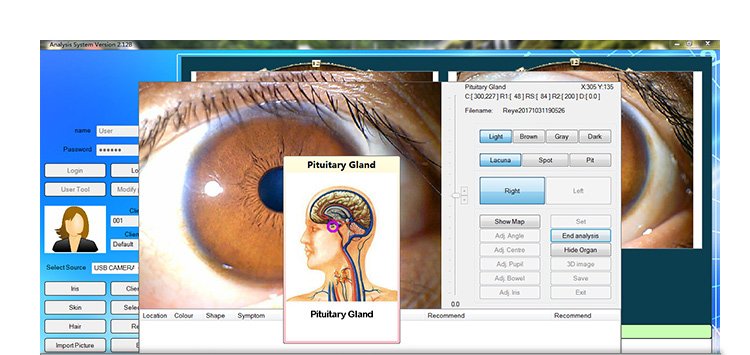 MAIKONG IRIDOLOGY software