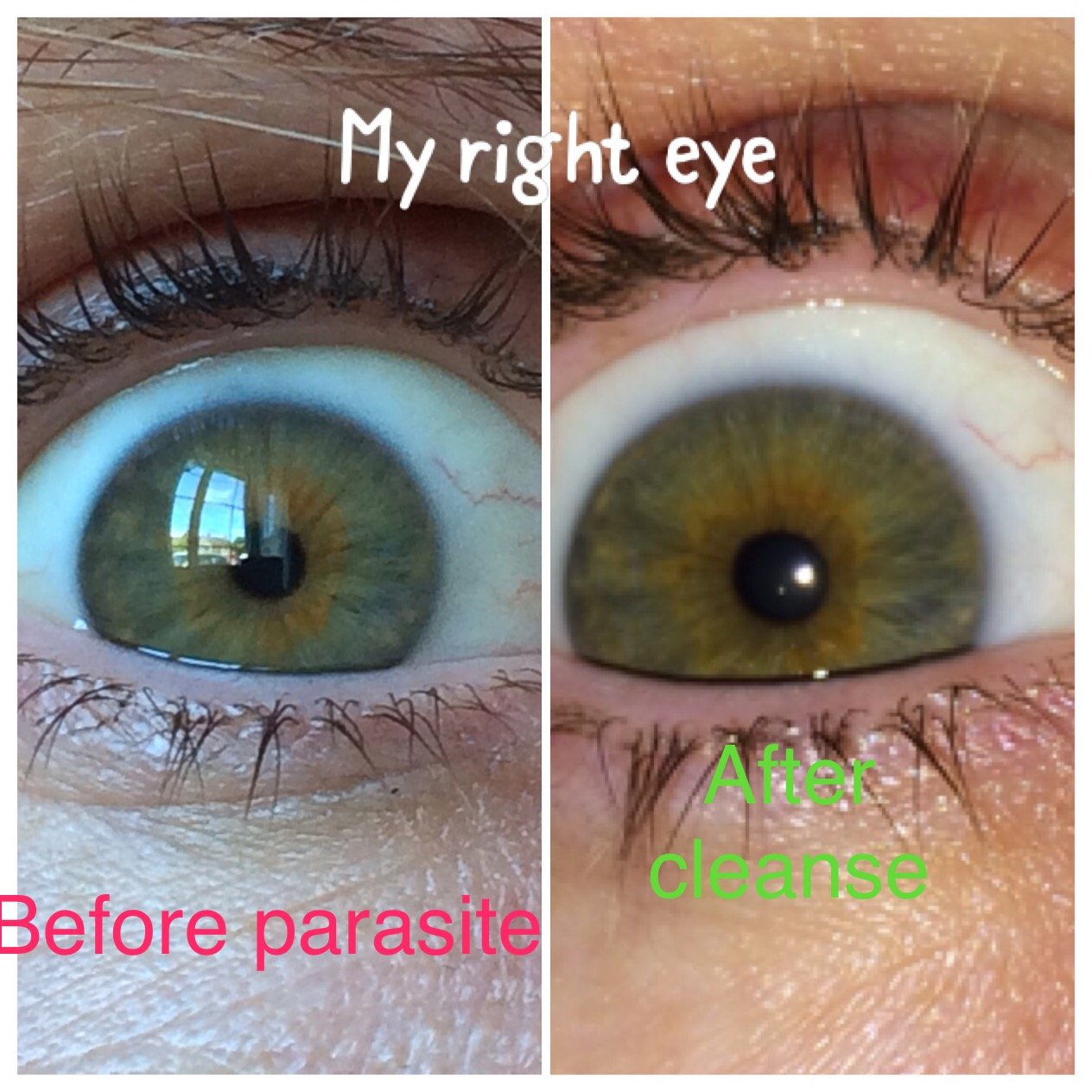 Comparaison entre analyse avec et sans iriscope professionnel