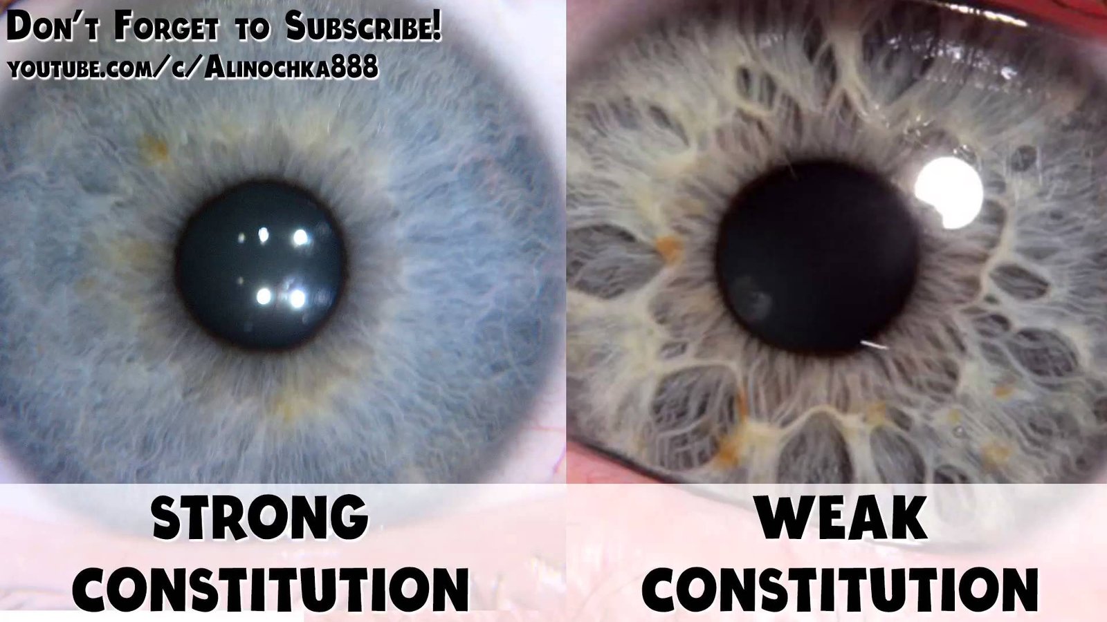 Comparaison entre analyse avec et sans iriscope professionnel