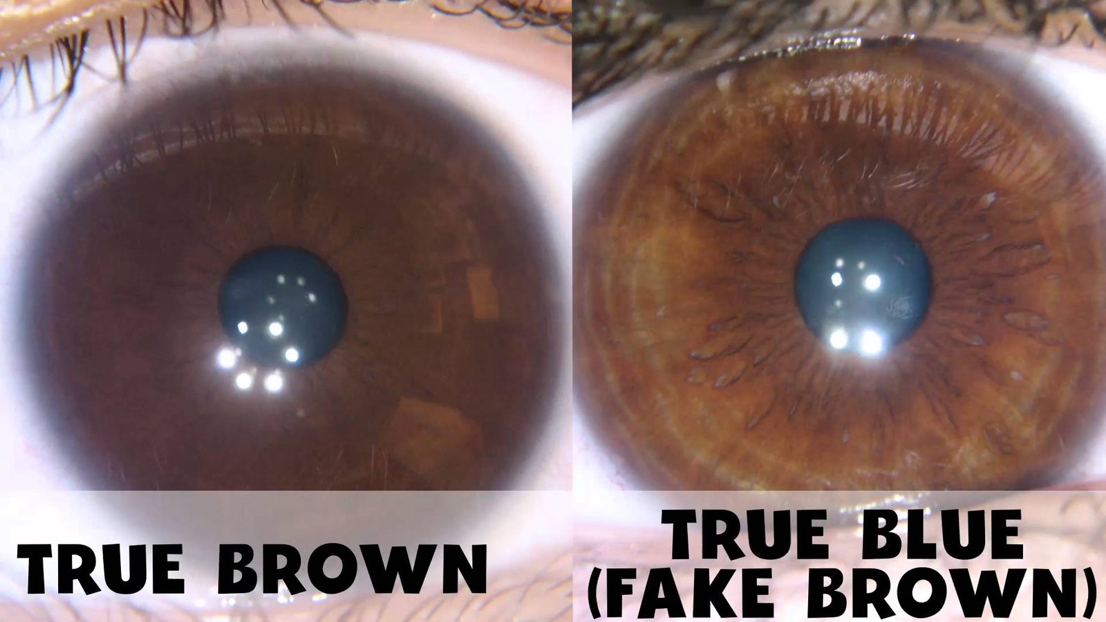 Comparaison entre analyse avec et sans iriscope professionnel