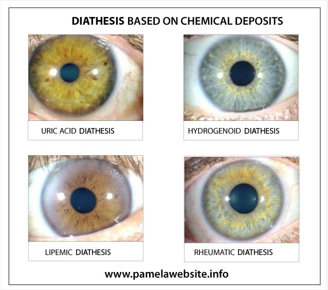 Comparaison entre analyse avec et sans iriscope professionnel