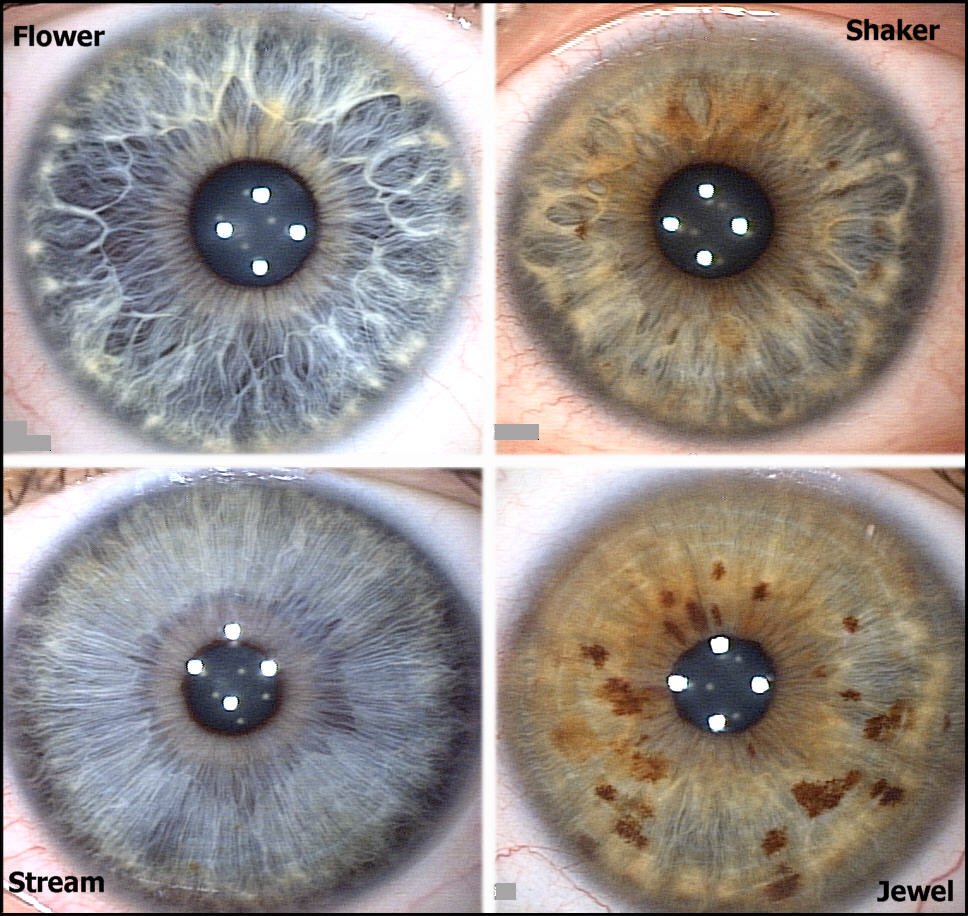 MAIKONG IRIDOLOGY pic
