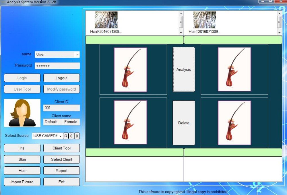 MAIKONG IRIDOLOGY SOFTWARE