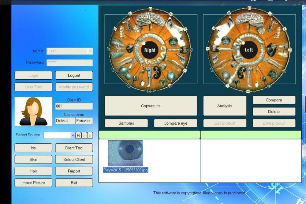 MAIKONG IRIDOLOGY SOFTWARE