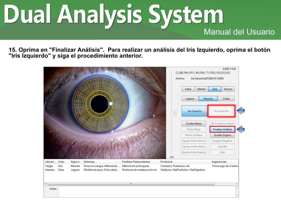 MAIKONG Appareil Photo Iridologie