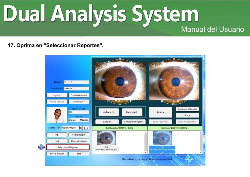 Loupe d'Iridologie MAIKONG