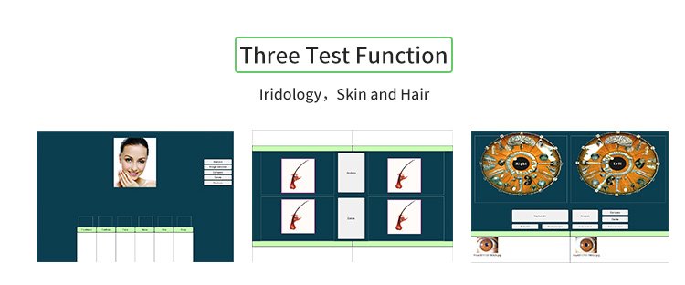 iriscope iridology camera