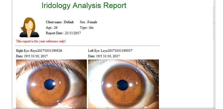 iriscope iridology camera