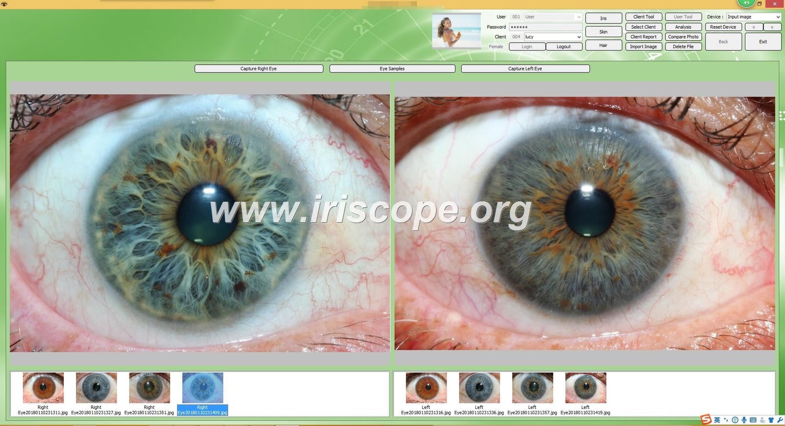 MAIKONG IRIDOLOGY SOFTWARE