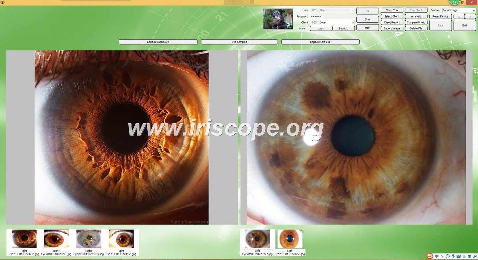 MAIKONG IRIDOLOGY SOFTWARE