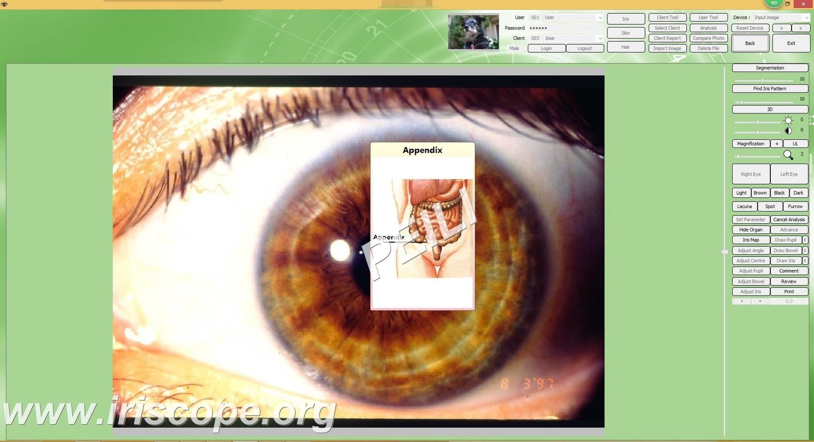 MAIKONG IRIDOLOGY SOFTWARE