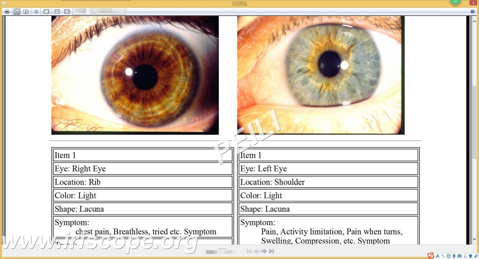 MAIKONG IRIDOLOGY SOFTWARE