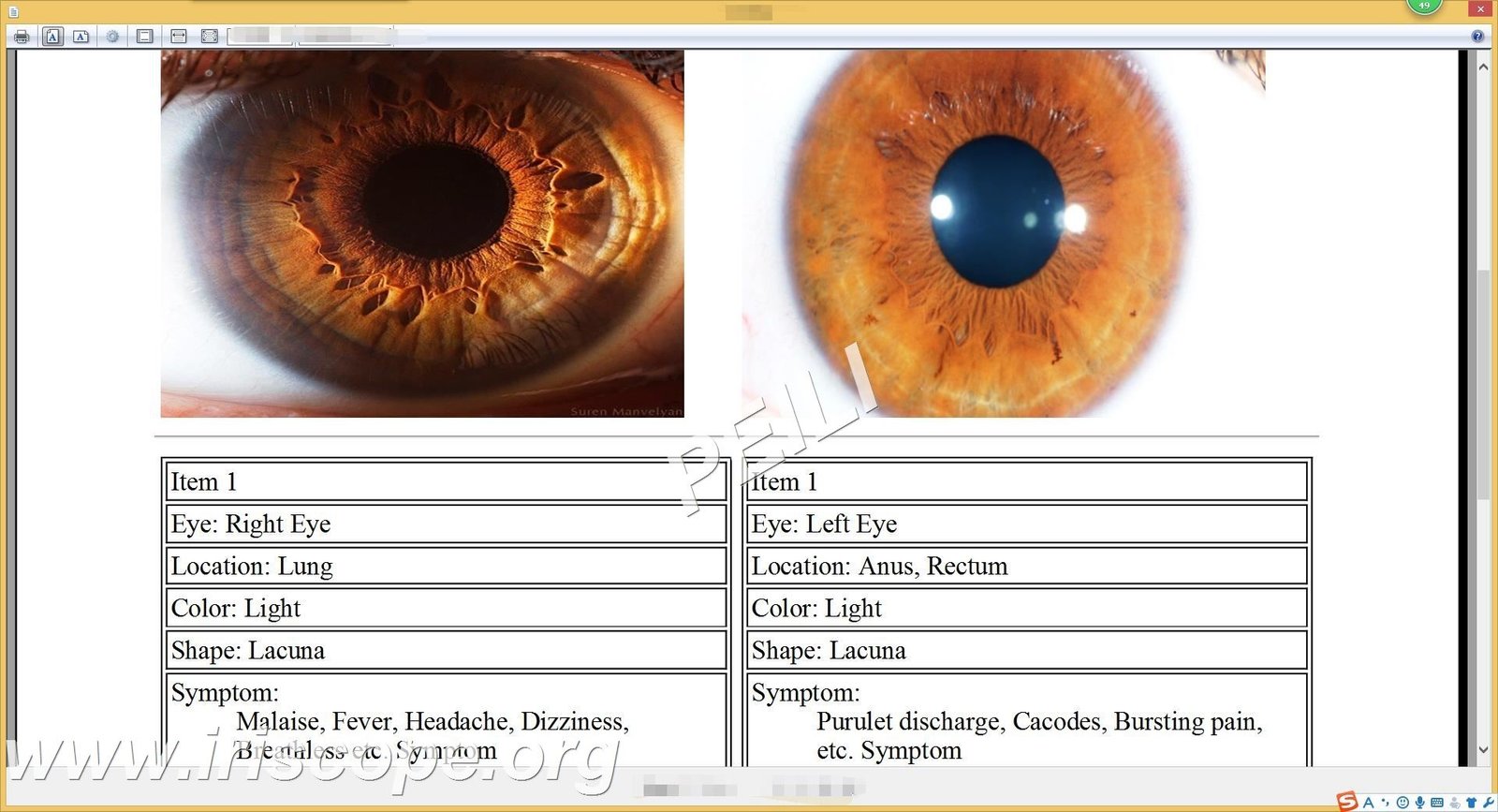 MAIKONG IRIDOLOGY SOFTWARE
