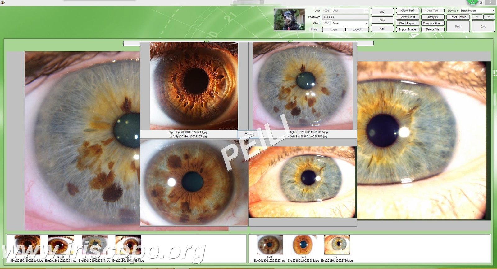 MAIKONG IRIDOLOGY Software