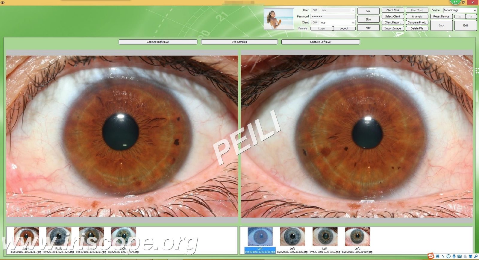 MAIKONG IRIDOLOGY Software