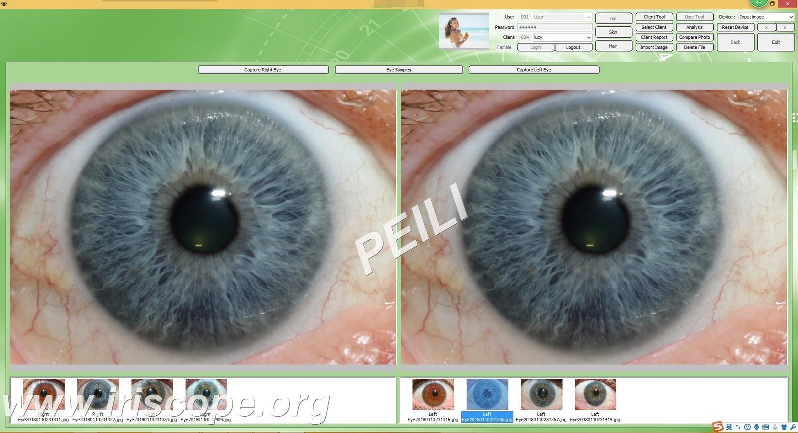 MAIKONG IRIDOLOGY SOFTWARE