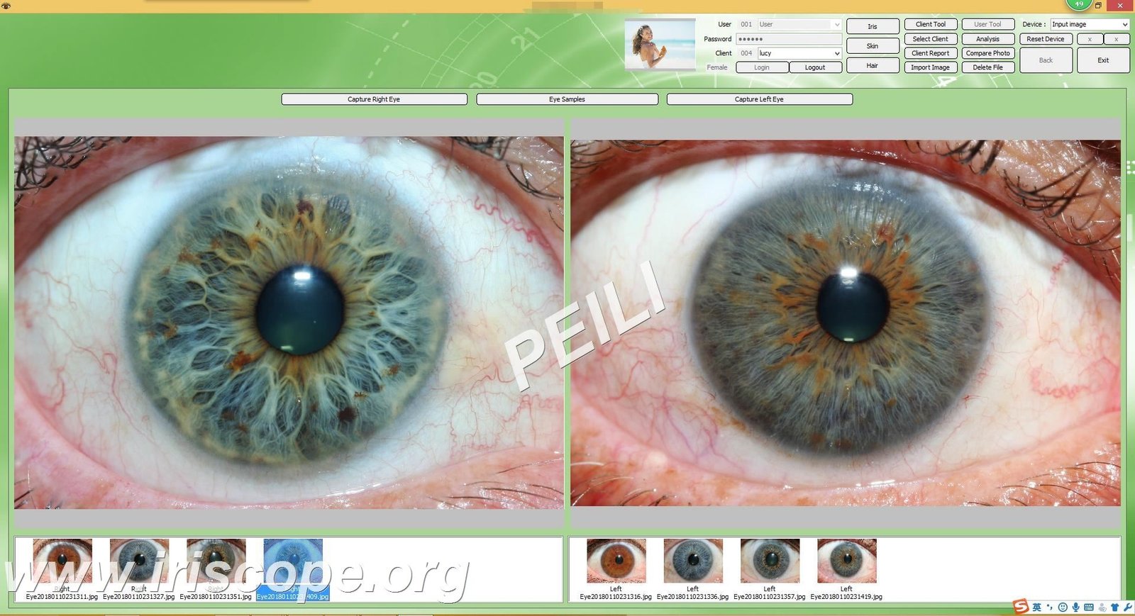 MAIKONG IRIDOLOGY Software