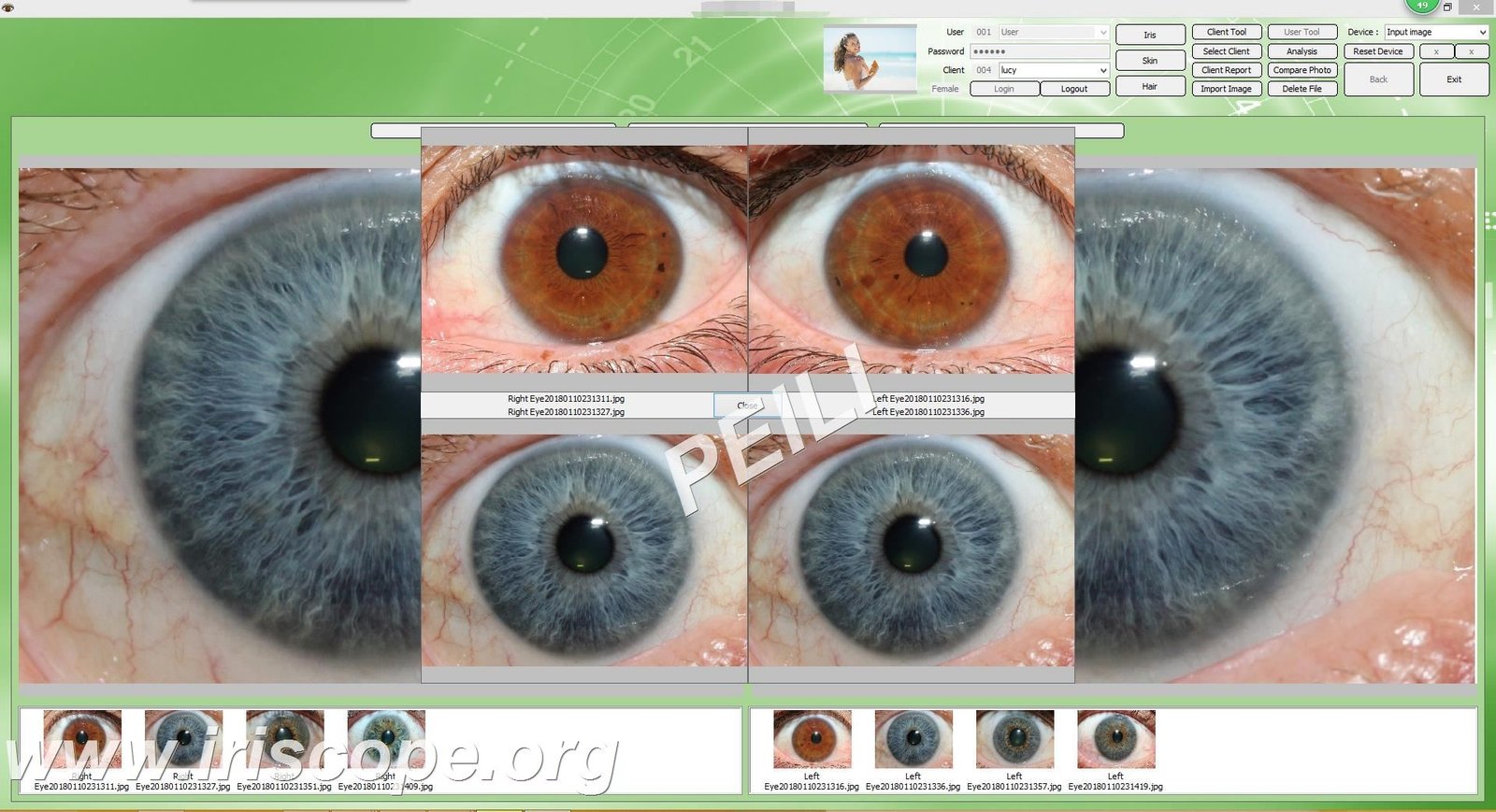 MAIKONG IRIDOLOGY Software