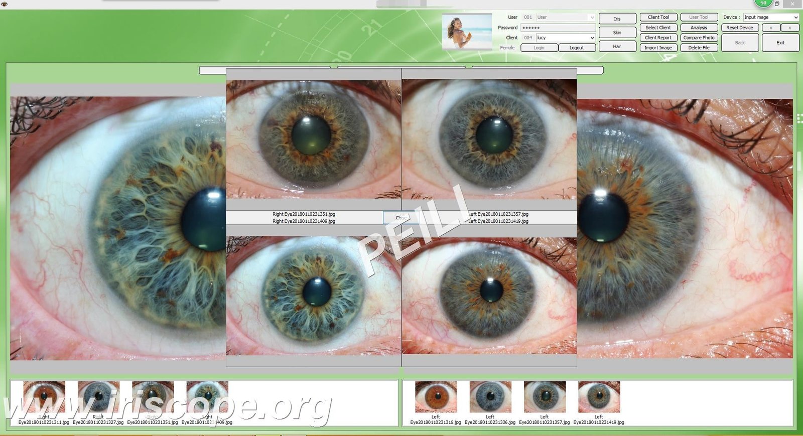 MAIKONG IRIDOLOGY Software