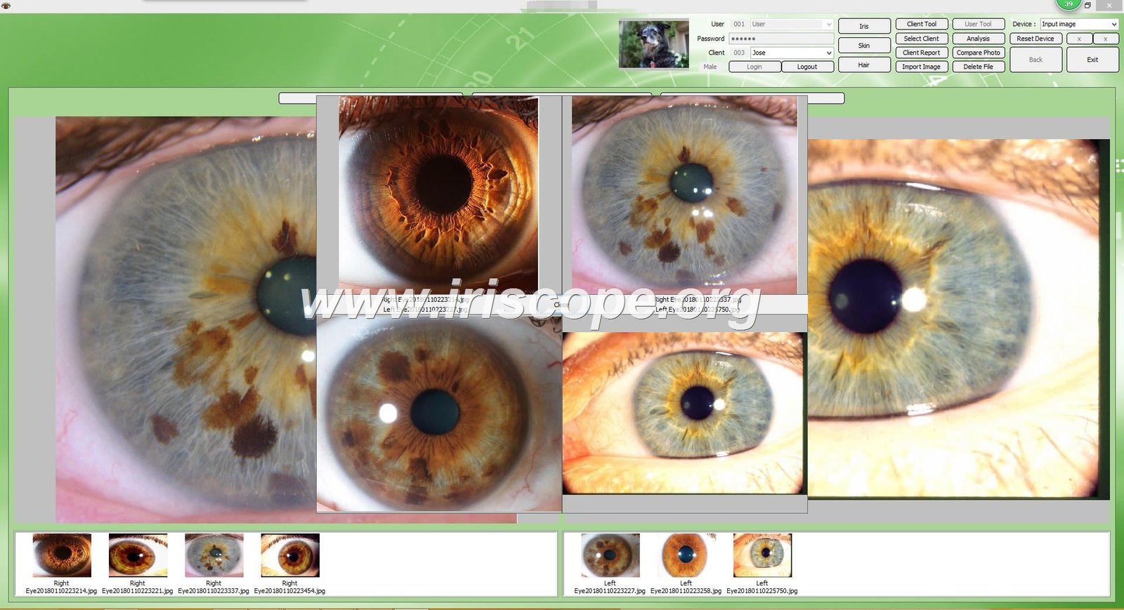 MAIKONG IRIDOLOGY software