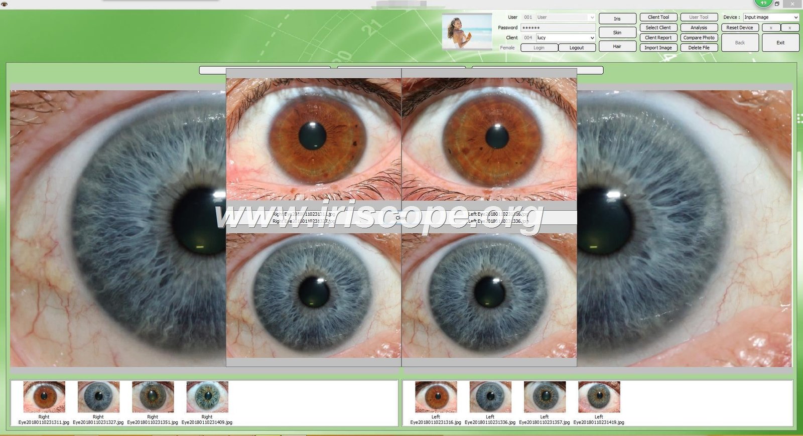 Iridology Software 4 MAIKONG IRIDOLOGY software