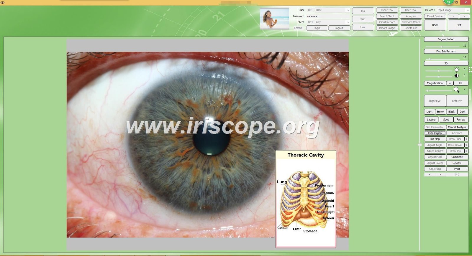 MAIKONG IRIDOLOGY software