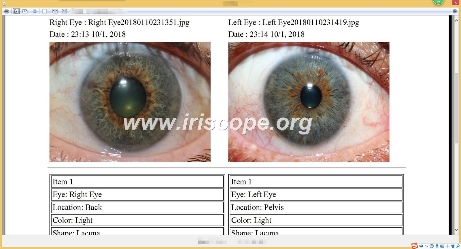 MAIKONG IRIDOLOGY software Reports
