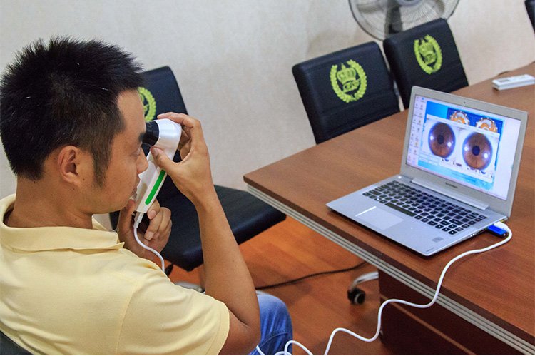 MAIKONG IRIDOLOGY CAMERA (499)