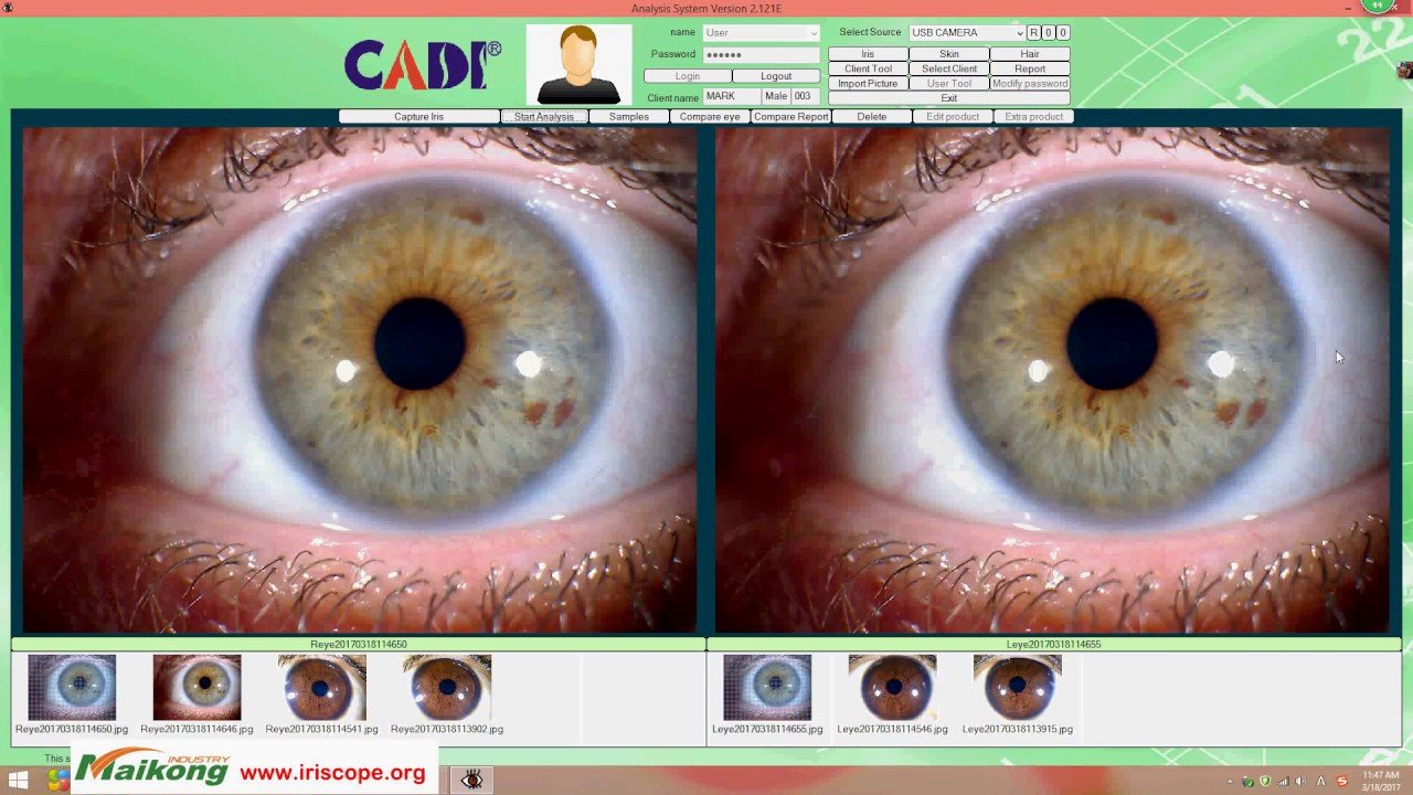 MAIKONG IRIDOLOGY software