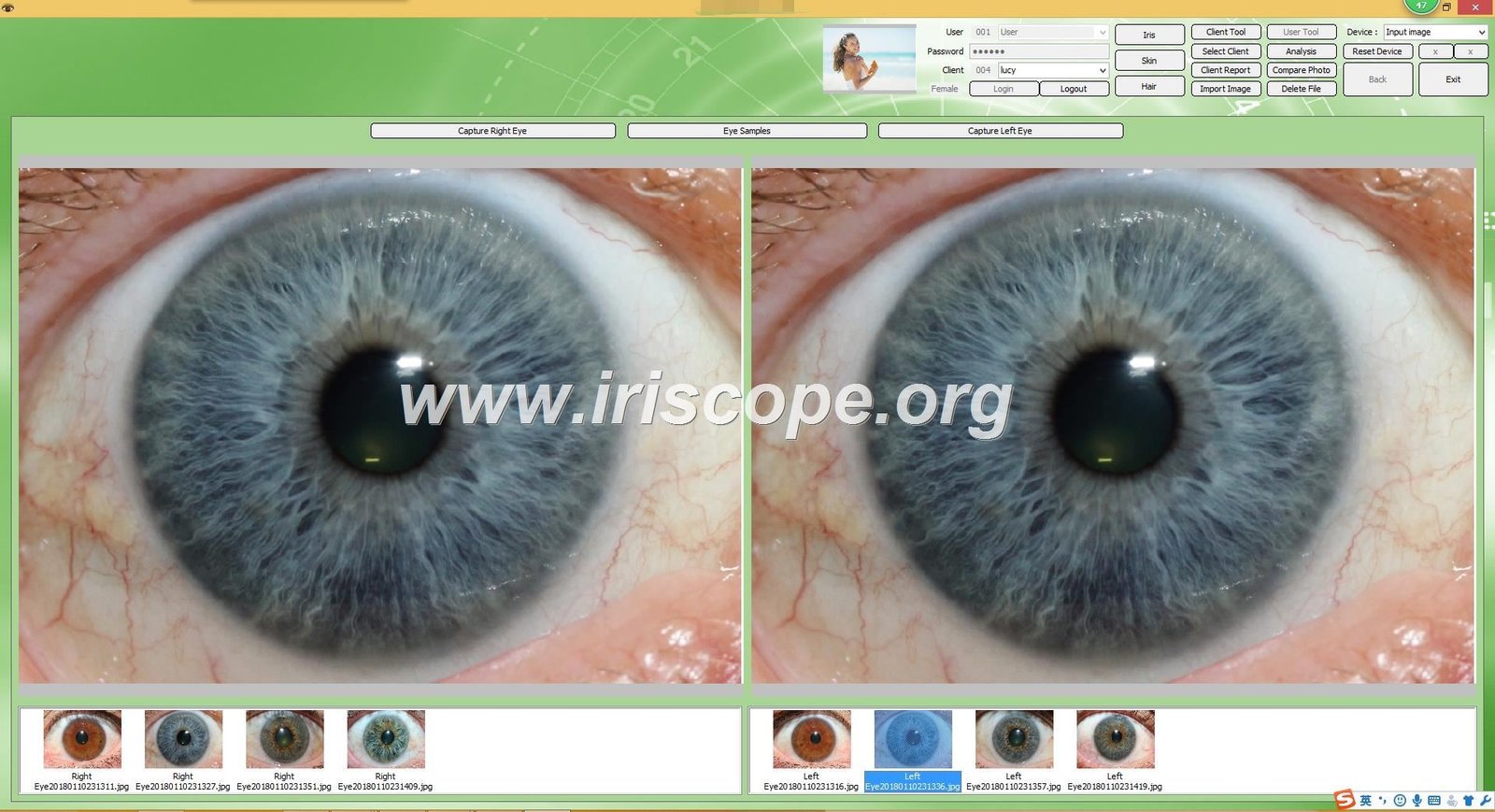 MAIKONG IRIDOLOGY software