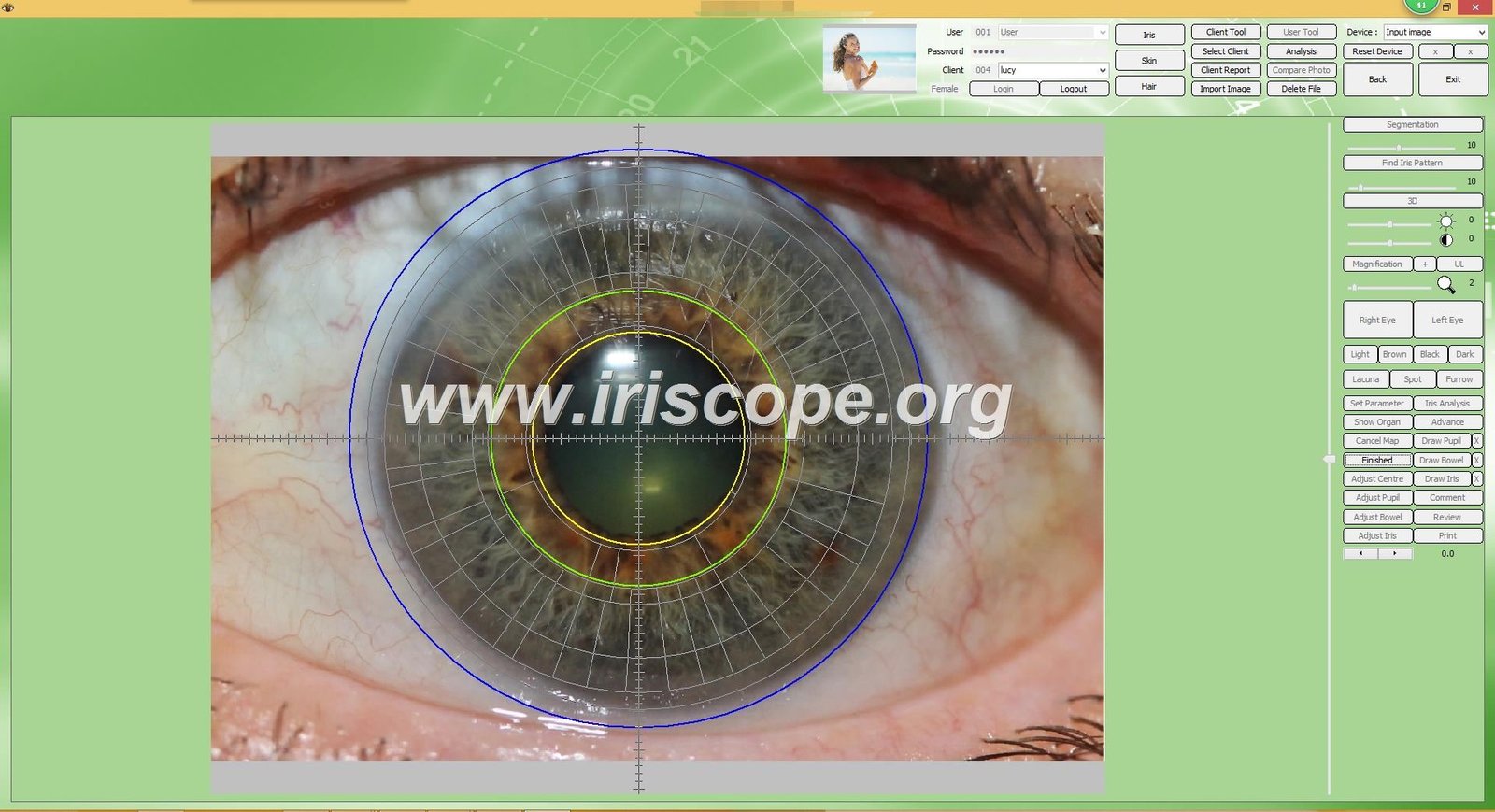MAIKONG IRIDOLOGY software