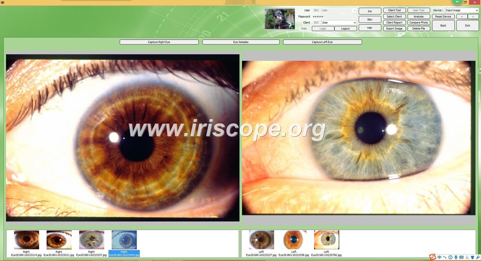 MAIKONG IRIDOLOGY softwar