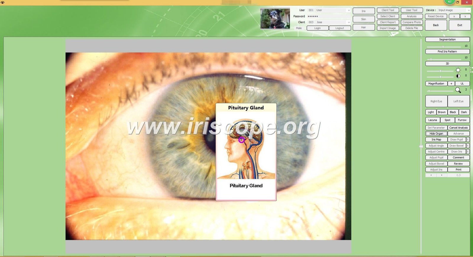 MAIKONG IRIDOLOGY software