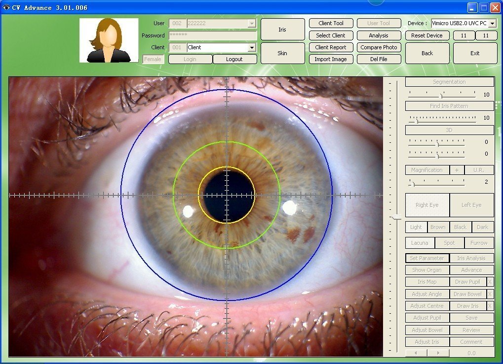 iridology software