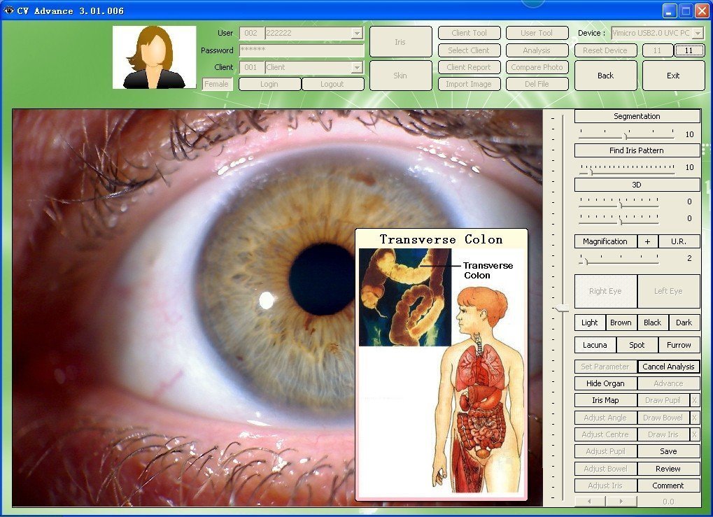 iridology software