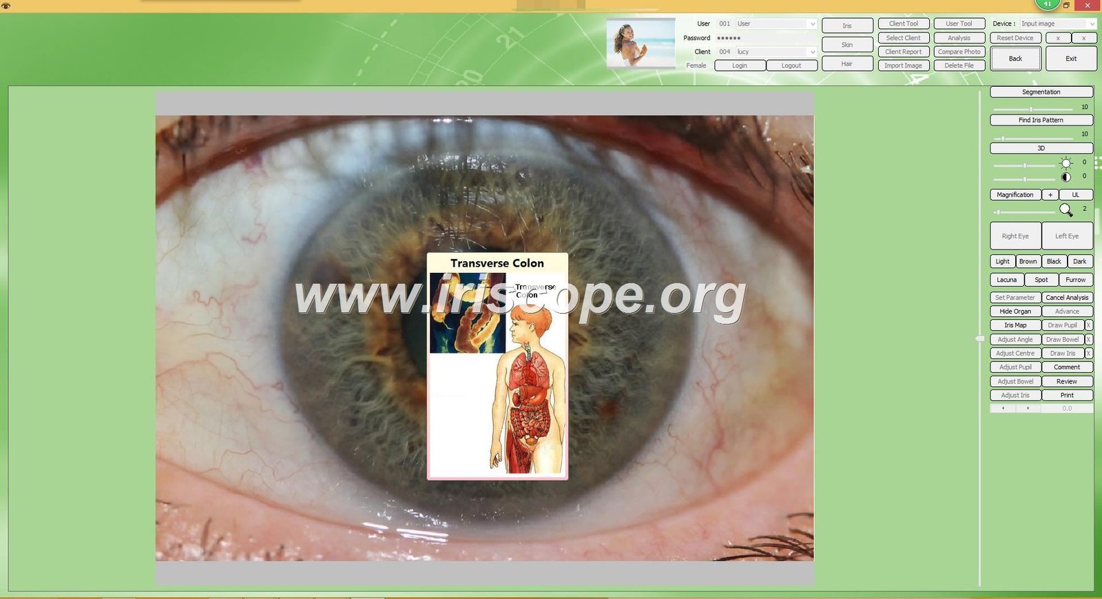 MAIKONG Iridologie software Analysis Reprosts