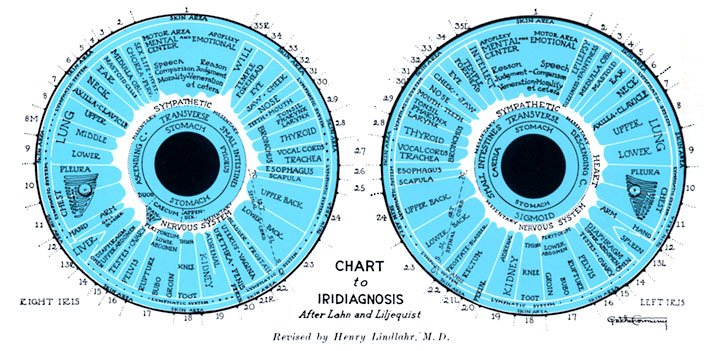 Carte Iridologie Jensen