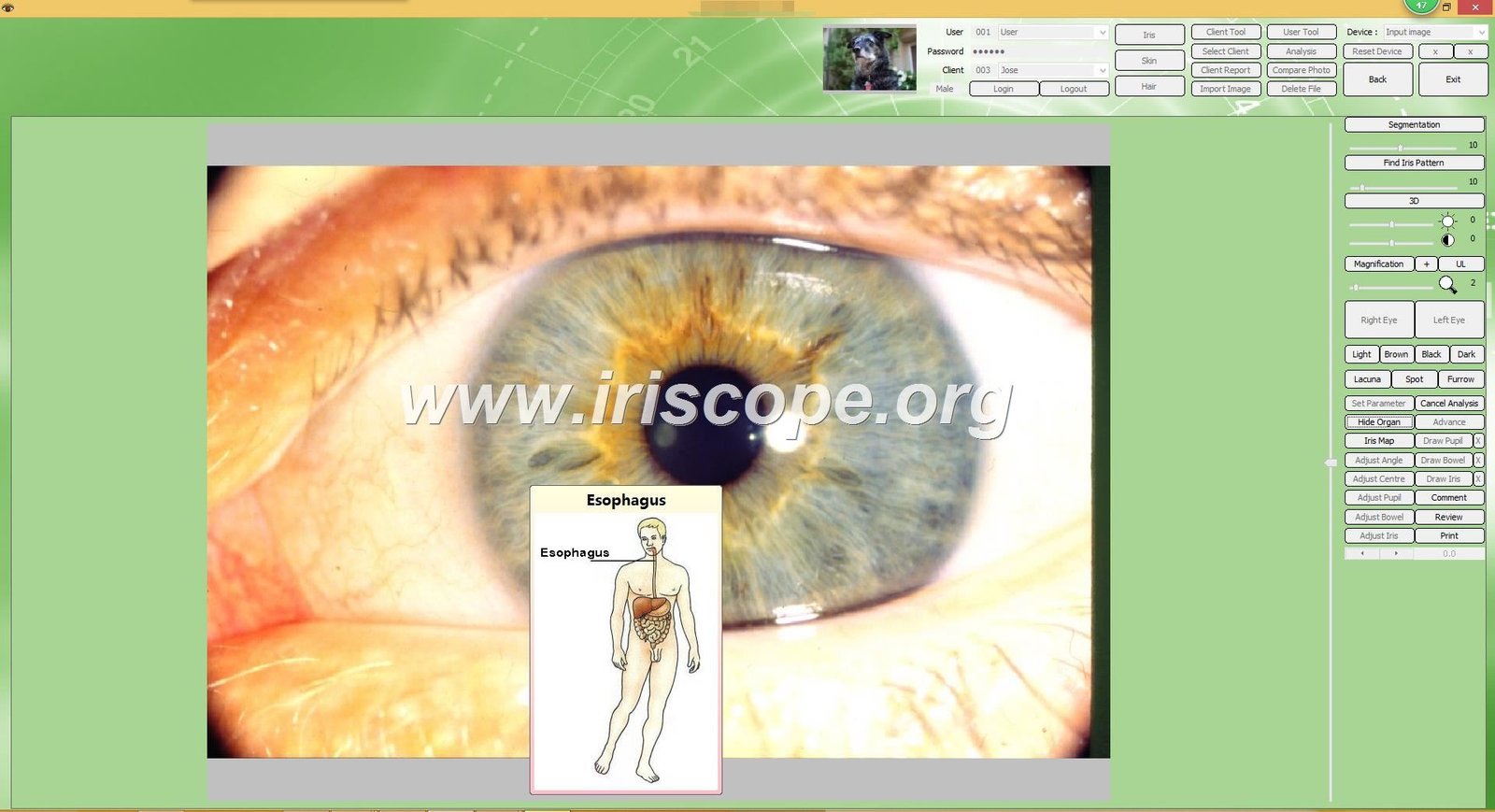 MAIKONG Iridologie software