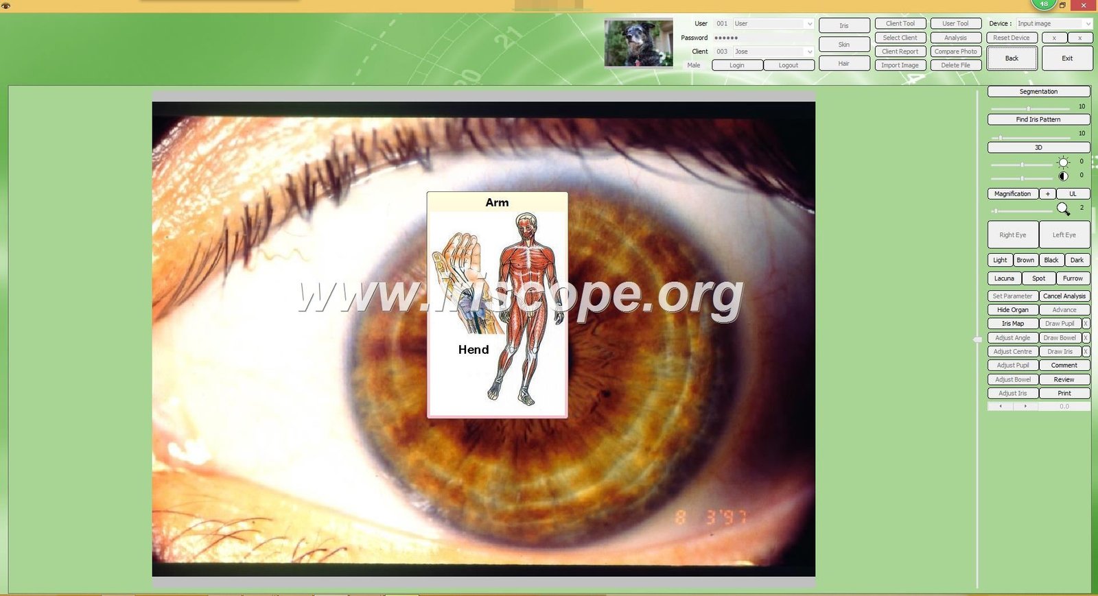 Macro Lens Iridology : Guide Complet pour Professionnels et Distributeurs 18 MAIKONG Iridologie software