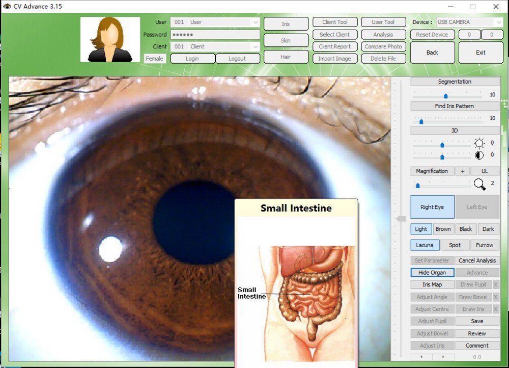 MAIKONG Iridologie software