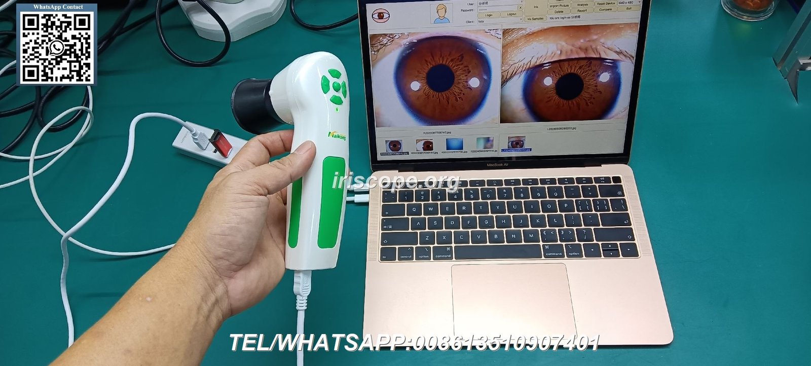 appareil photo pour iridologie