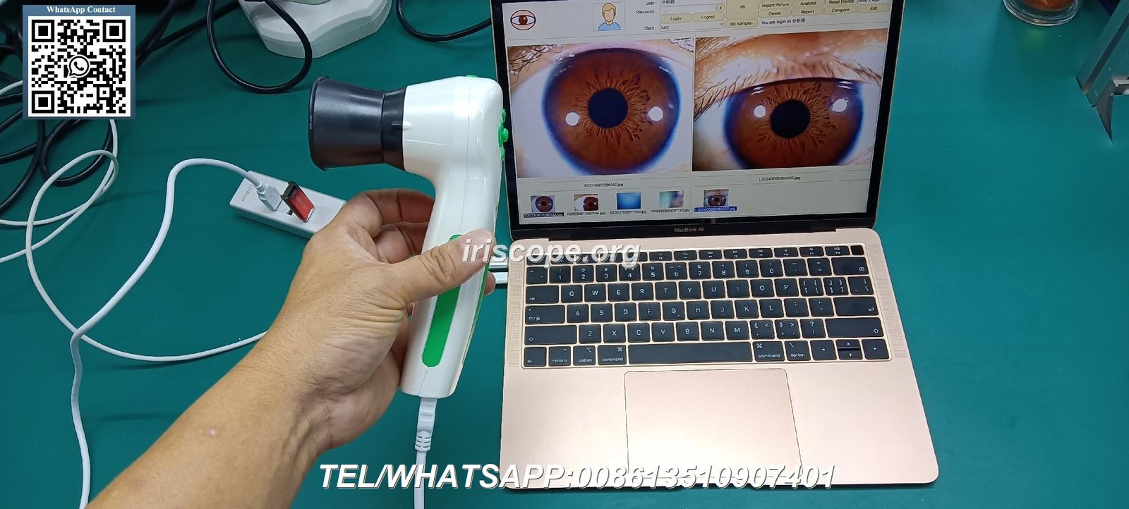appareil photo pour iridologie